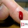 生活小知識(shí)：刀割到手怎樣處理