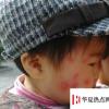 生活小知識：夏天被蚊子咬了如何快速消腫
