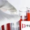 生活小知識：如何判斷孩子的血型 根據(jù)父母血型推斷孩子血型