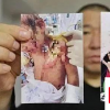 撫順6歲被虐女童父親望嚴懲前妻
