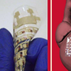 植入式設備可以監(jiān)測和治療心臟病