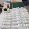 3D打印的腳使步態(tài)領(lǐng)先于足病學(xué)學(xué)生