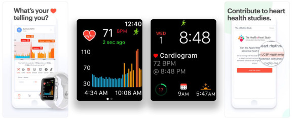Apple Watch心電圖應(yīng)用程序擊敗EKG樂(lè)隊(duì)發(fā)現(xiàn)錯(cuò)誤的心跳