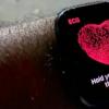 蘋(píng)果與強(qiáng)生公司共同研究Apple Watch應(yīng)用程序是否可降低中風(fēng)風(fēng)險(xiǎn)