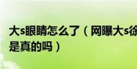 大s眼睛怎么了(網(wǎng)曝大s徐熙媛眼睛動(dòng)過(guò)刀子是真的嗎)