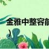 金雅中整容前后（關(guān)于金雅中整容前后的簡(jiǎn)介）