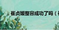 崔貞媛整容成功了嗎(崔貞媛整容)