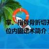 掌、指骨骨折切開復(fù)位內(nèi)固定術(shù)（關(guān)于掌、指骨骨折切開復(fù)位內(nèi)固定術(shù)簡介）