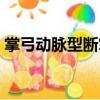 掌弓動(dòng)脈型斷掌（關(guān)于掌弓動(dòng)脈型斷掌簡(jiǎn)介）
