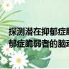 探測潛在抑郁癥脆弱者的腦動態(tài)模型研究（關于探測潛在抑郁癥脆弱者的腦動態(tài)模型研究簡介）