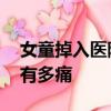 女童掉入醫(yī)院開水桶遭特重度燒傷 難以想象有多痛