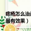 痣瘡怎么治最有效果 吃什么藥（痣瘡怎么治最有效果）