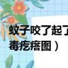 蚊子咬了起了毒疙瘩圖片真實(shí)（蚊子咬了起了毒疙瘩圖）