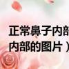 正常鼻子內(nèi)部的圖片和腺體對(duì)比圖（正常鼻子內(nèi)部的圖片）