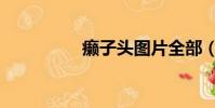 癩子頭圖片全部(癩子)